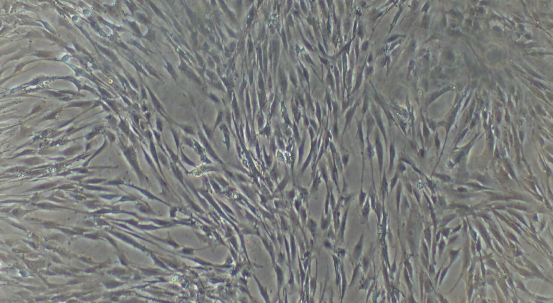 骨髓间充质干细胞的应用